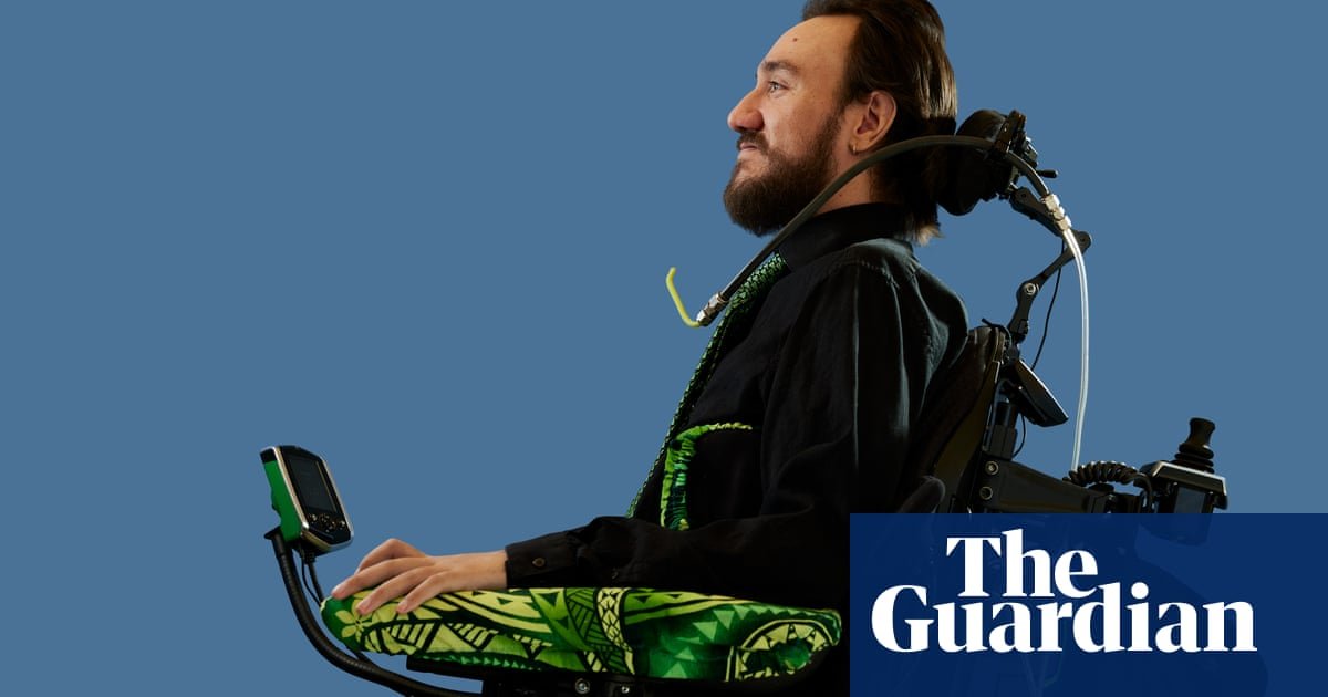Elon Musk put a chip in this paralysed man’s brain. Now he can move things with his mind. Should we be amazed – or terrified?