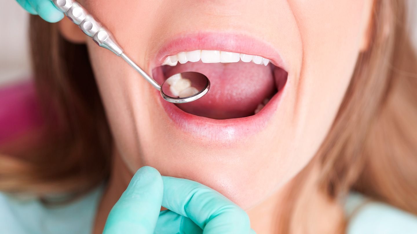How Crohn’s Disease Affects Your Mouth